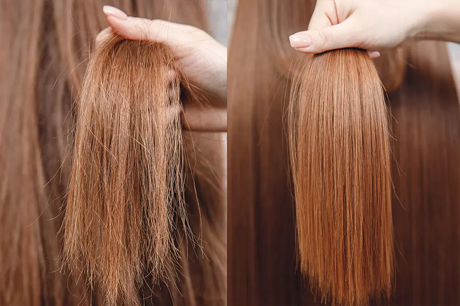 Keratin 11