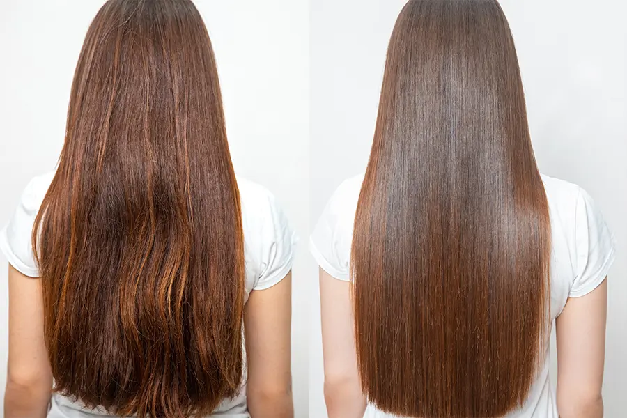 Keratin 3
